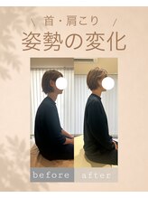 アオ 香椎(AO)/before→after