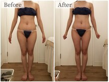 ボーレーヴ(beau reve)/ブライダル/インディバ/痩身