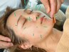 【群抜き！美容鍼スタンダード】 鍼数制限なしで驚きの40分を体験できる！