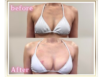 ジュエルリング(Jewel Ring)/バストアップ【恵比寿代官山】