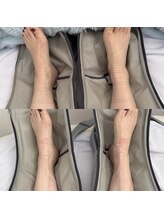 ラテプラス(LATEE＋)/足の浮腫み【40代】