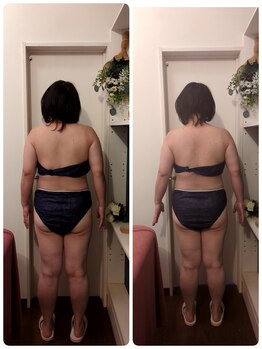 ヨサパーク アカーシャ(YOSA PARK AKASHA)/肩こり悩みに