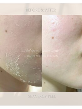 ラヴィン なんばスカイオ店(Lovin)/シーナジーピーリング