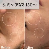 ヴィアージュ(Viage)