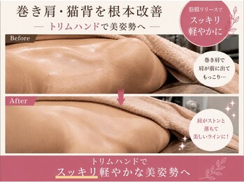 オーシャン(OCEAN)の写真/首肩こりにサヨナラ♪トリムハンドで筋膜リリース！姿勢改善で巻肩・猫背もスッキリ！大人気メニューです☆