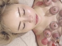 凜の雰囲気（最新カッピングや最新遠赤外線カッサも新登場！ぜひお試しを♪）