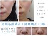 エステ専用個室確約■小顔変化◎首肩,小顔矯正,鼻or目矯正,リフトアップ65分