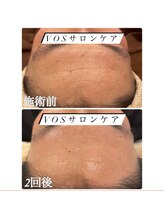 ビューティー アディクト(Beauty addict)/美肌に導く！