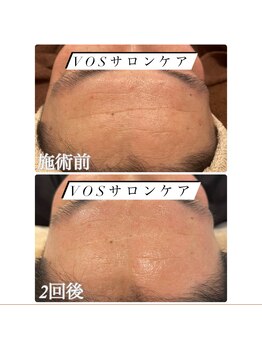 ビューティー アディクト(Beauty addict)/美肌に導く！