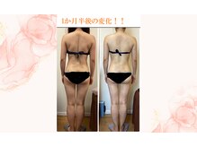 ルピナージュ(Lupinage)の雰囲気（６種類の痩身技術を贅沢に組み合わせて、サイズダウン♪）