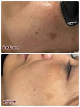 ケースタイル(k.style)/お客様before after