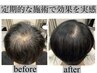 【育毛促進/抜け毛改善はこちら】　ヒト幹細胞育毛促進ヘッドスパ