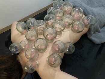 リブレナトゥス(LIBRENATUS)/2025年4月から導入カッピング