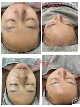 サロンヤザワ(Salon yazawa)/シェービング