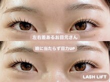 エクラ(Eclat)/左右差あるお目元さん