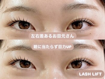 エクラ(Eclat)/左右差あるお目元さん