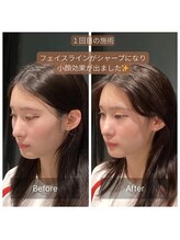 サリエ(S'allier)/お客様のビフォーアフター