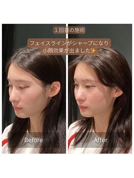 サリエ(S'allier)/お客様のビフォーアフター