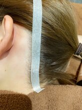 ビオール(美all)/お肌の奥まで届くは光脱毛器★