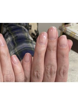 爪の悩みを解消できる（ケア含む）