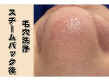 ザ ピーチ(THE PEACH)/スチームパックで毛穴がうきでる