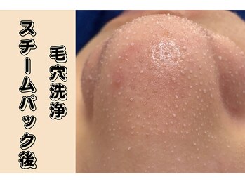 ザ ピーチ(THE PEACH)/スチームパックで毛穴がうきでる