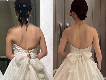 ヨサパーク ビウィズ(YOSAPARK 美 with)の写真/上半身集中痩身！むくみを解消し、冷え固まったセル脂肪もスッキリ◎ほっそり二の腕・くびれをゲット！