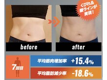 サロンジム(SalonGym)/電磁パルス