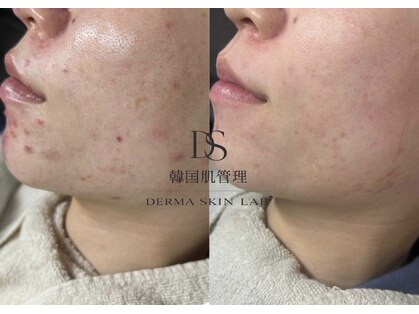 ルアンビューティー メディカルプラス(Luan beauty MEDICAL+)の写真