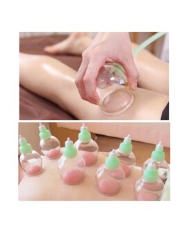 エステティック リセージュ 銀座店/人気オプション　カッピング