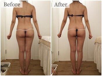 ボーレーヴ(beau reve)/ブライダル/インディバ/痩身