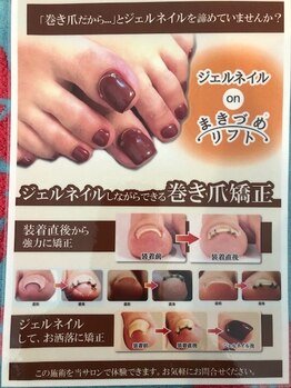 マナ(mana)/巻き爪リフト