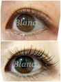 アイラッシュサロン ブラン COCOSA熊本店(Eyelash Salon Blanc) 自分のまつ毛が好きになる！ラッシュアディクト愛用中★