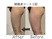 ナニワ ビューティー(naniwa beauty)の雰囲気（本気の痩身！フォトギャラリーご覧ください☆）