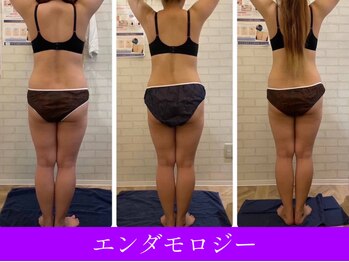 オーシャンブルー 大分店(OCEAN BLUE)/エンダモロジー