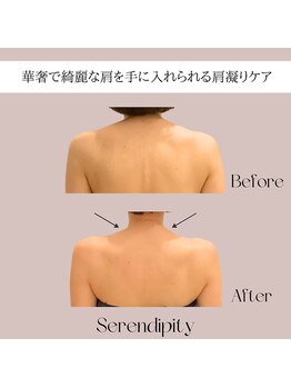 セレンディピティー(Serendipity)/【肩凝りケアで華奢な肩も】