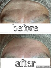 フィール(feel)/Before/After