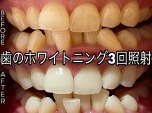 ヴィオール 名古屋栄店(VIOR)/笑顔が輝くホワイトニング☆