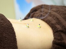 エムハナ鍼灸院(M.hana鍼灸院)の雰囲気（【全身鍼灸】優しい刺激からしっかりめの刺激まで調整出来ます）