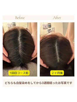 アイシー(I Sea)/女性の髪髪・頭皮のお悩み解決!