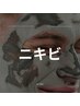 【ニキビ集中肌管理＋顔脱毛】￥15000～￥27500