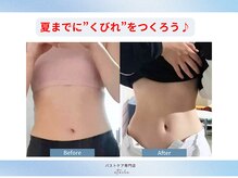 エトワールの雰囲気（寸胴体型なんて言わせない！人生一番のボディラインへ★）