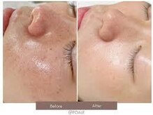 ウェルビーイング(well-being)