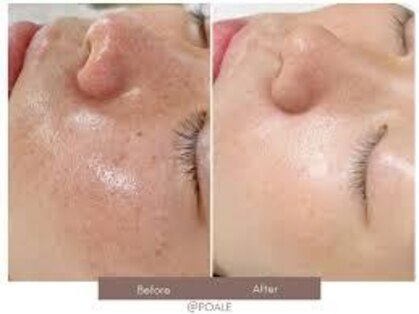 ウェルビーイング(well-being)の写真