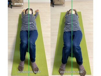 エヴォストレッチ(EVO STRETCH)/50代女性【肩周りの違和感】