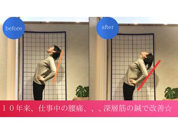 鍼灸院シマダ 宇多津(鍼灸院SHIMADA)/腰痛・根本改善