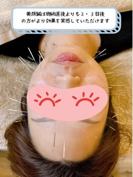 あんどら鍼灸接骨院/フェイスラインや目の疲れにも！