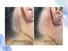 ラヴィアンローズ 各務原店(La vie en Rose)/ムダ毛を一気に処理したい