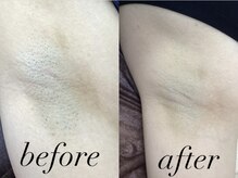 ラ ルアナ(La Luana)/【両脇しっかり脱毛♪】新規¥500