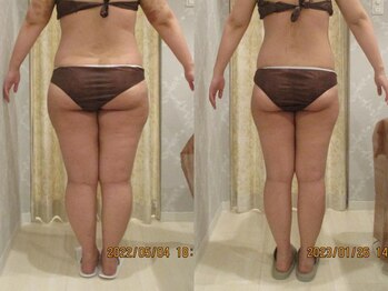 プロラボスパ 姫路店/20代後半 症例写真